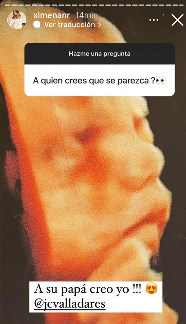 Bebé de Ximena Navarrete